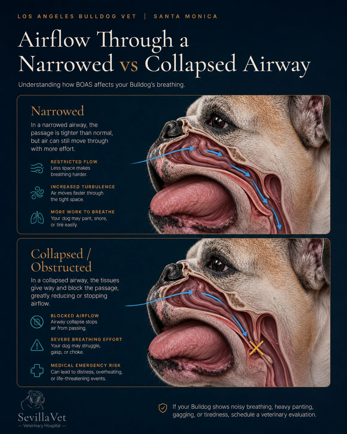 Educational infographic comparing narrowed airway airflow with collapsed obstructed airway